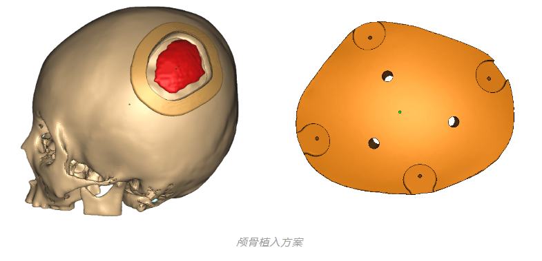 3D打印機